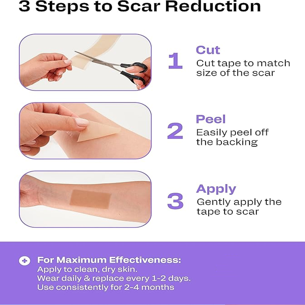 4Roll Scar Sheets Roll - Silic - Medical Tape recension och pris